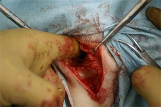 フレンチブルドック手術中の写真1（筋肉を閉じる前）筋肉の隙間に指が入ります。