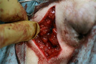 フレンチブルドック手術中の写真2（筋肉を閉じた後）指が入っていた隙間が無くなりました。傷の中心に使用した青い糸がいくつか見えます。